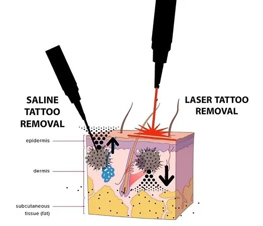 Pmu Verwijderen Brows