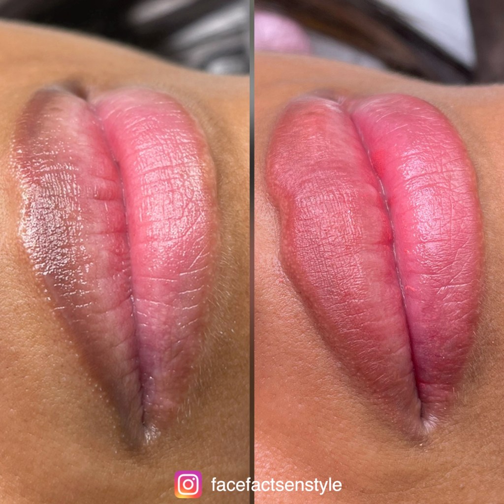 Melanine Lip Blus in Rotterdam